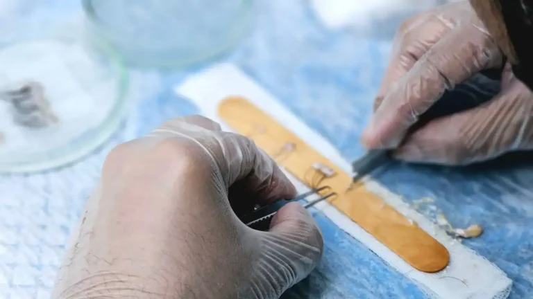 Implants capillaires : ce qu&rsquo;une greffe de cheveux peut vraiment faire